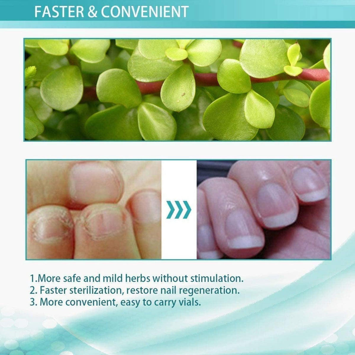 Fungal Nail Treatment - 10ml Liquid Highly Effective Kills Toenail Fungus